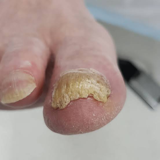 Nail and foot care photo