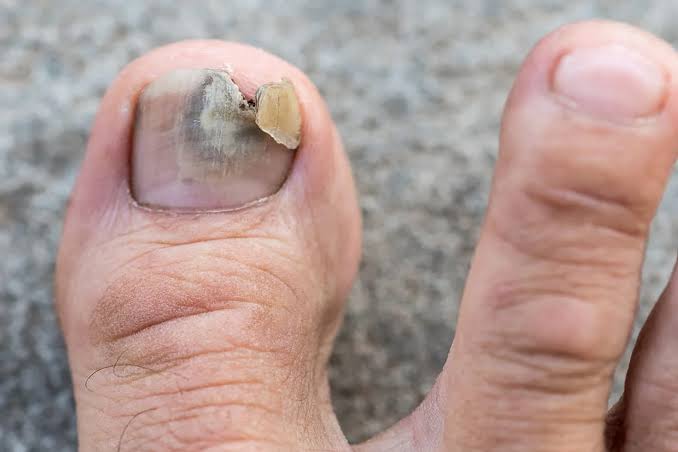 Foot care photo