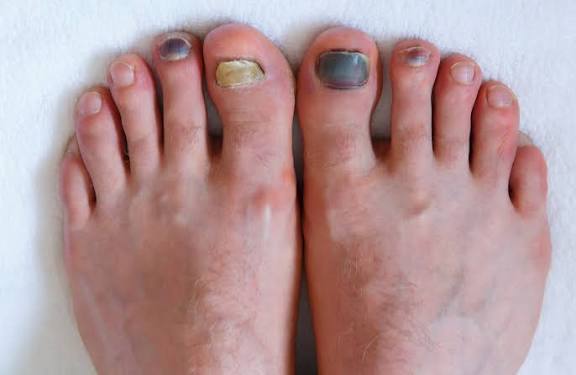 Nail and foot care photo