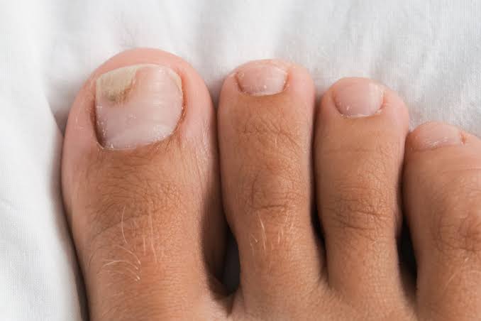 Toenails close-up