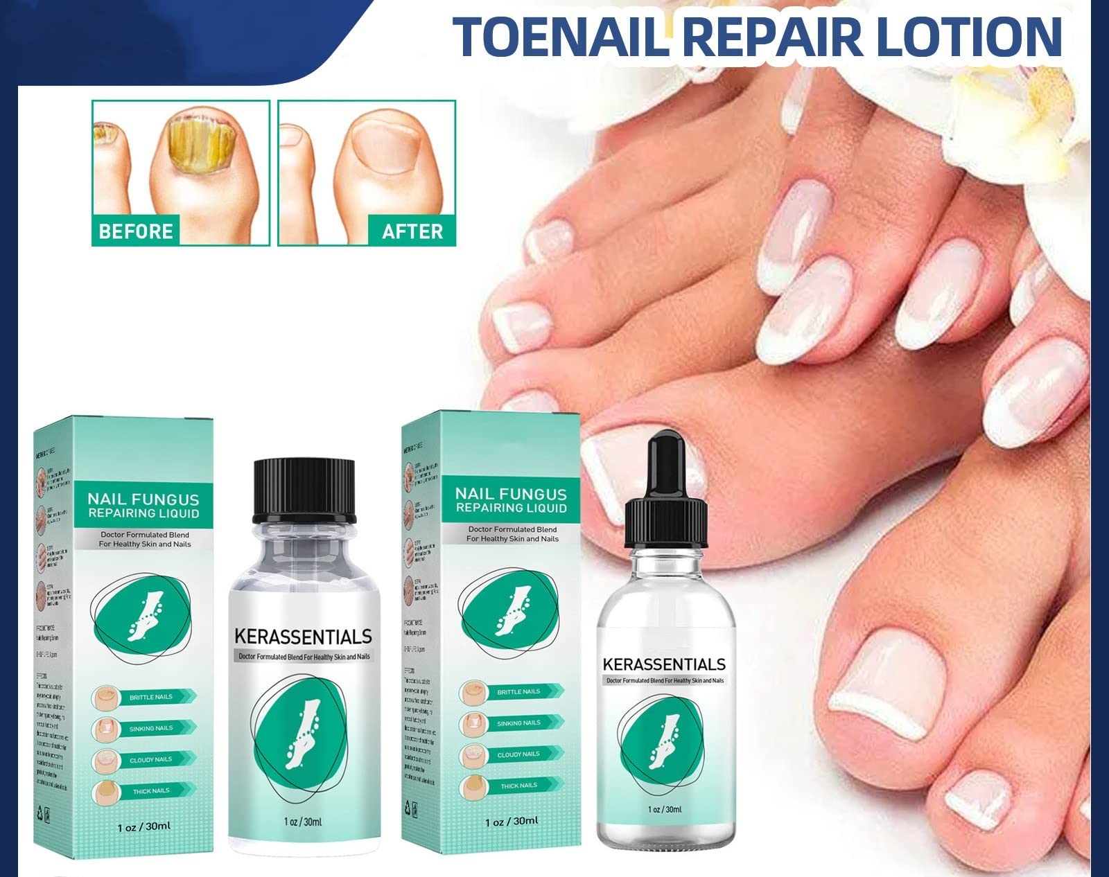 Nail and foot care photo