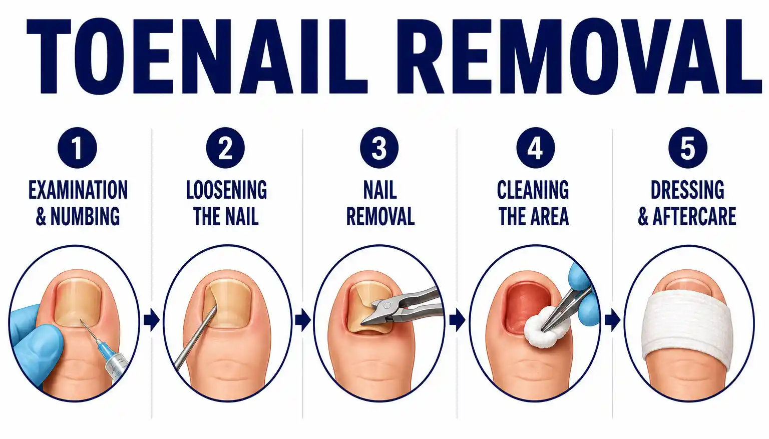 Nail and foot care photo