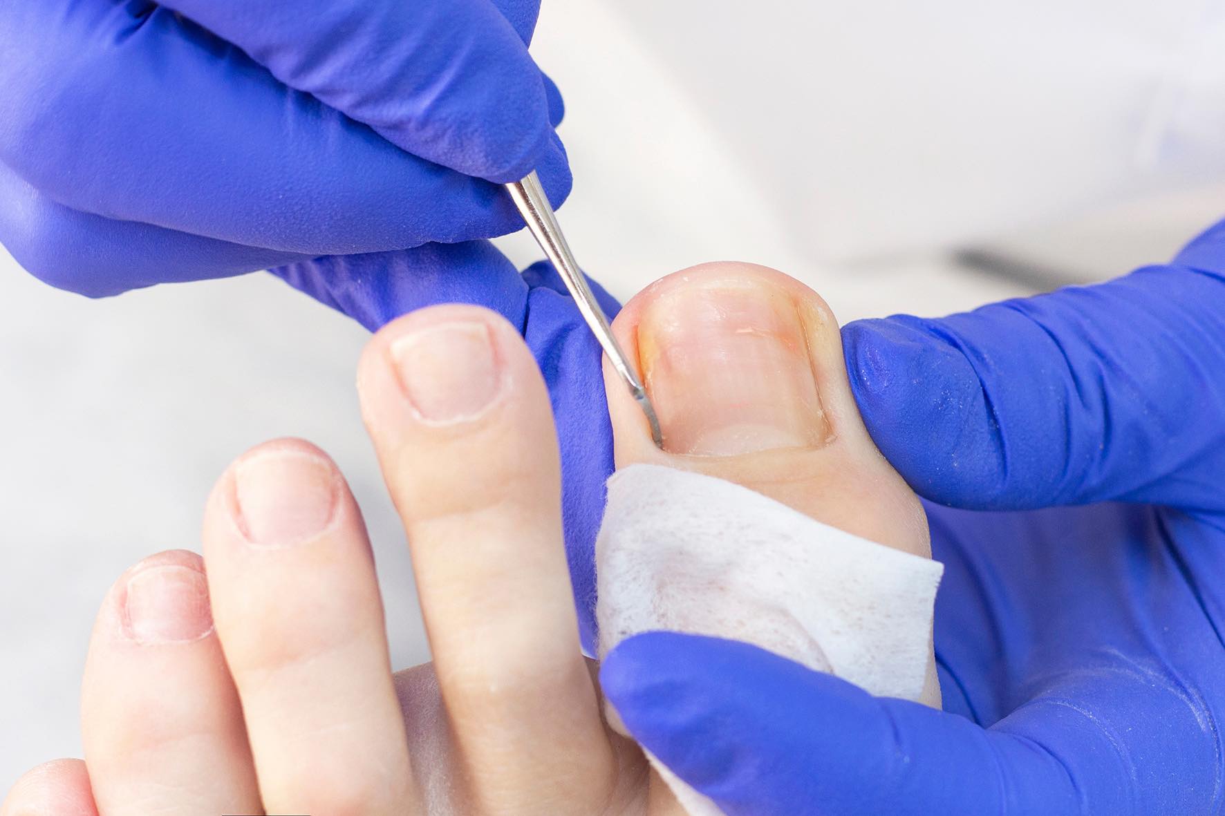 Nail and foot care photo