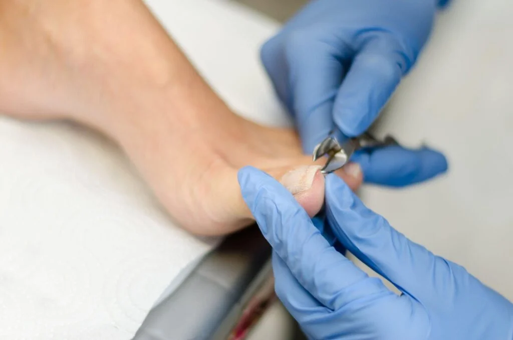 Nail and foot care photo
