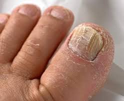 Nail and foot care photo