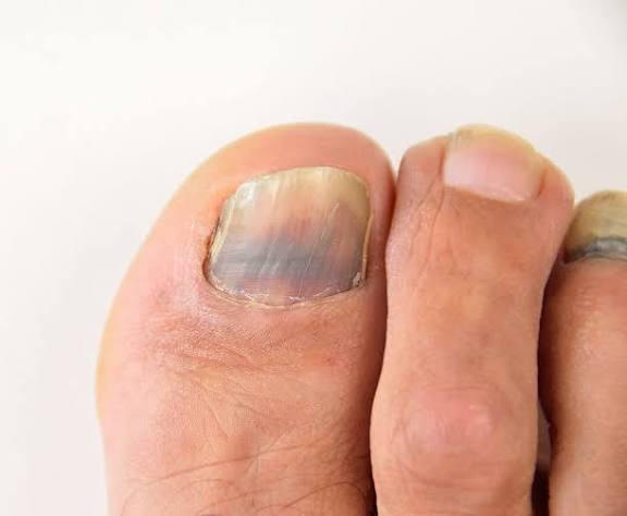Nail and foot care photo