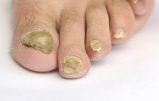 Nail and foot care photo